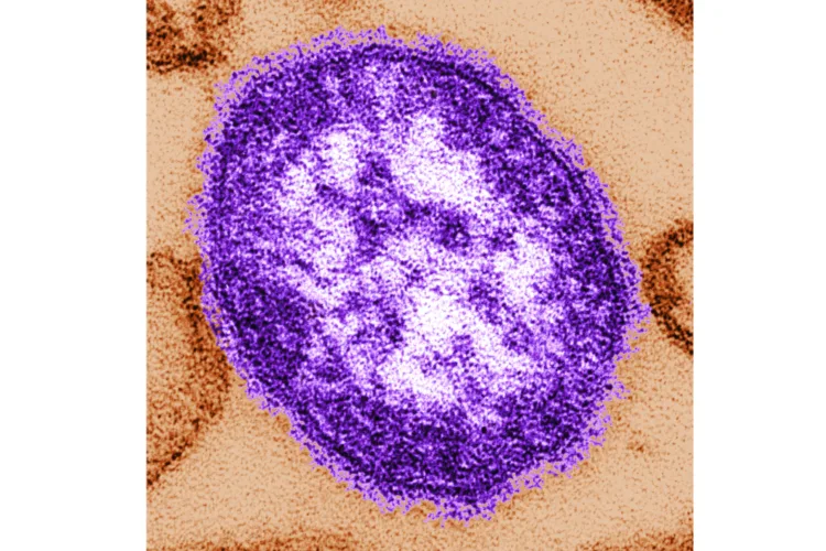 Pa. reports first 2 measles deaths in the US this year, both people unvaccinated